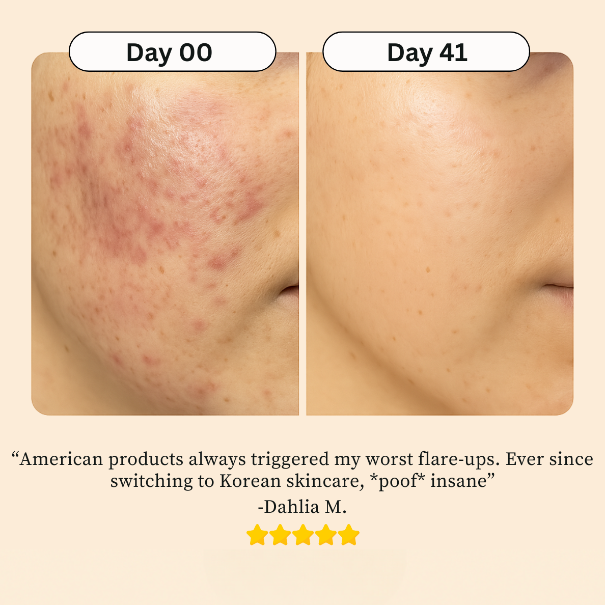 Korean Skin Care Toner Pads - 100ct.